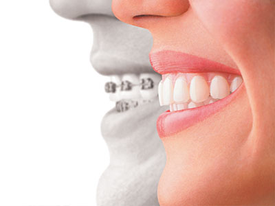 The image features a split-screen photograph of a smiling mouth on the left side and a person s face with a wide smile on the right, both against a white background.