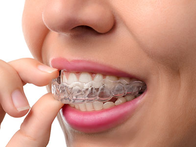 The image shows a person with clear braces on their teeth, holding up a finger with a bracelet-like device attached to their fingernail, which appears to be a nail care tool.