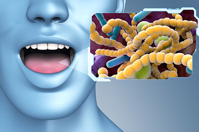 The image shows a 3D rendering of a human head with an open mouth above a graphic representation of bacteria, suggesting a connection between oral health and bacterial infection.