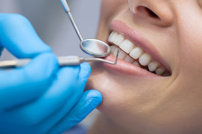 The image shows a dental professional performing a dental procedure on a patient s teeth, with the patient smiling and the professional using a drill and other dental tools.