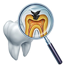 The image displays a magnified view of a human tooth with an open crown, showing the internal structure including pulp and nerve endings, viewed through a magnifying glass with a transparent circular overlay that reveals the interior of the tooth, highlighting its anatomical details.