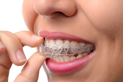 The image shows a person with braces holding a toothbrush with their teeth, demonstrating oral hygiene practices.