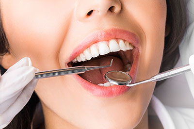 The image shows a woman with an open mouth, holding dental tools, likely a dentist during a dental procedure.