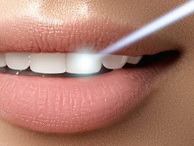 The image features a close-up of a person s lips with a focus on their teeth, set against a blurred background, which suggests an advertisement for dental care or cosmetic treatments.